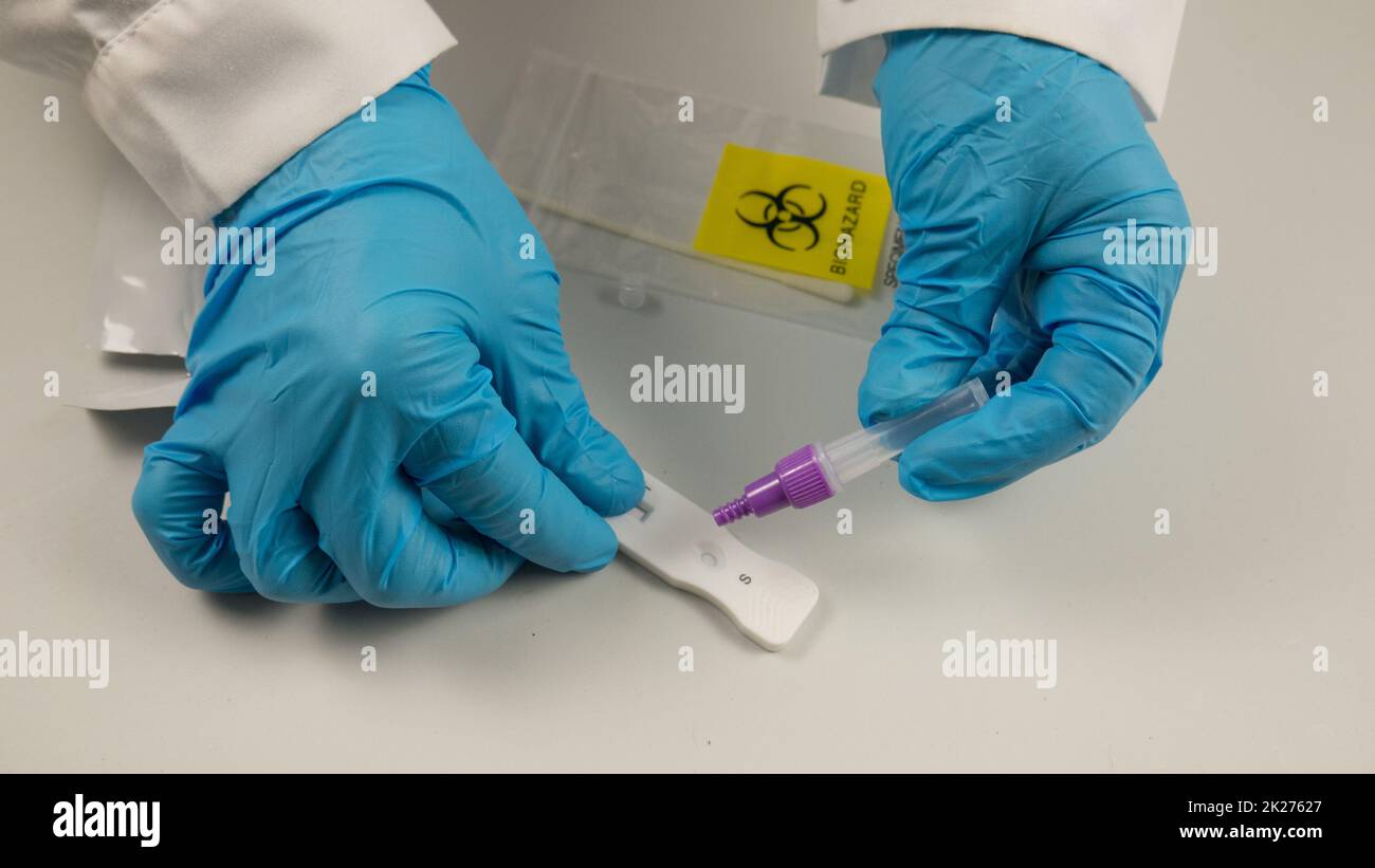 antigenic swab, covid 19 virus detector, with test tube, liquid, negative result, performed by the hands of a doctor with blue gloves. Stock Photo