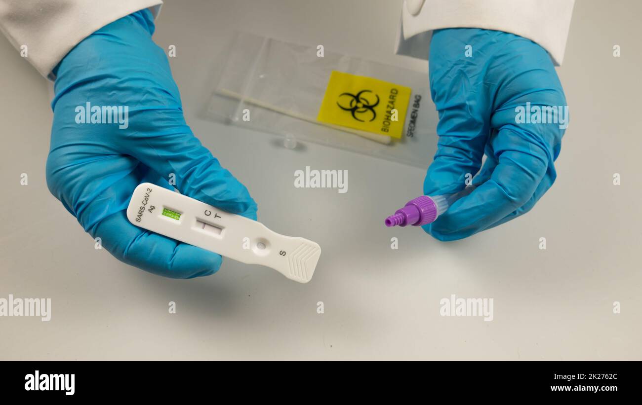 antigenic swab, covid 19 virus detector, with test tube, liquid, negative result, performed by the hands of a doctor with blue gloves. Stock Photo