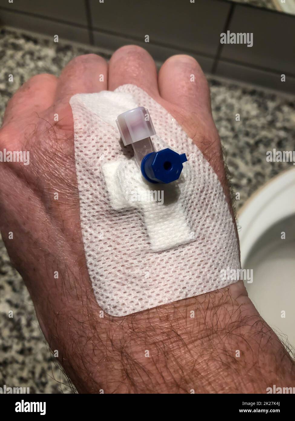 A cannula is stuck in one hand for vein access Stock Photo Alamy