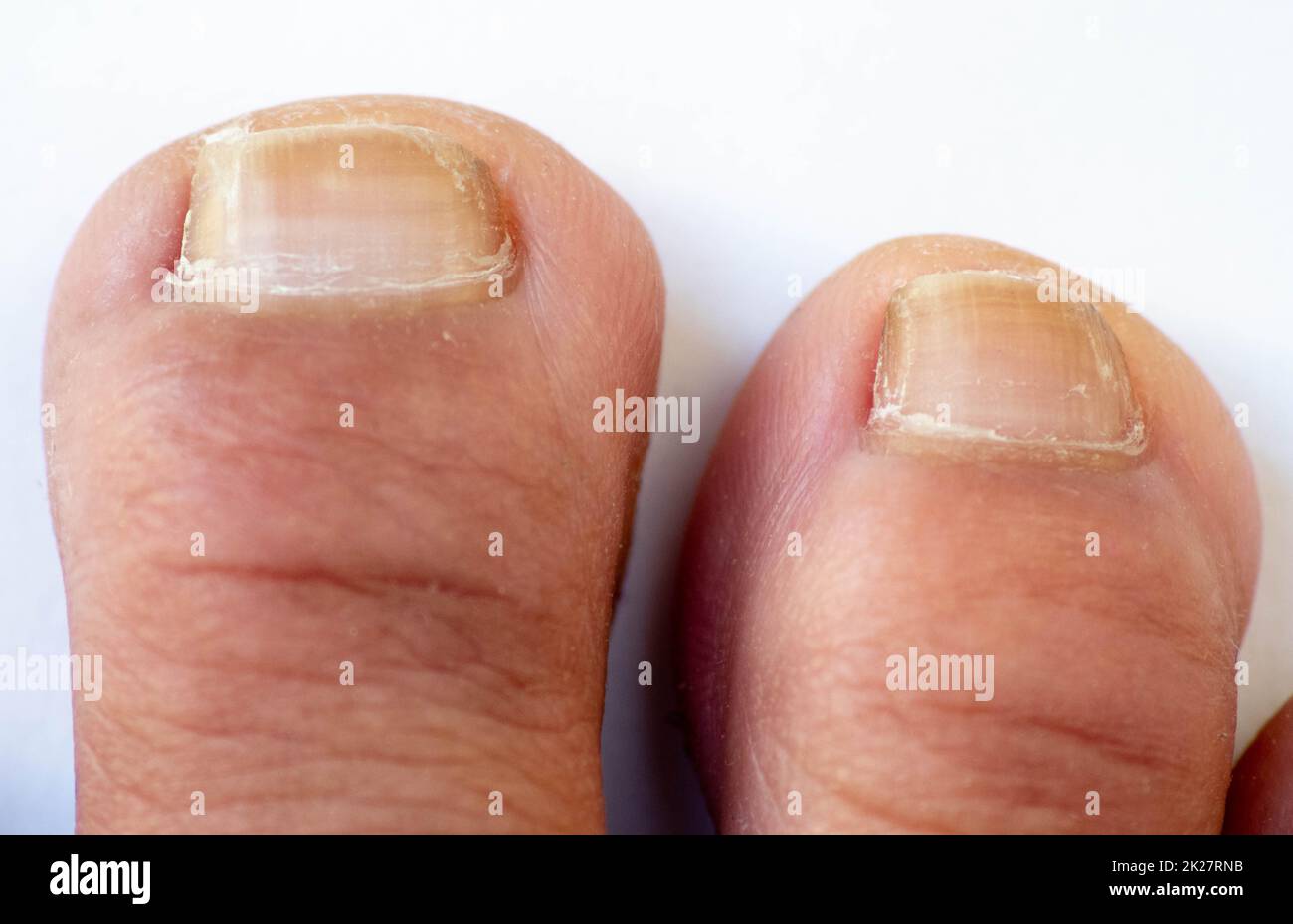 Toes, hands and nails. Male human body parts 20 to 30 years old Stock Photo