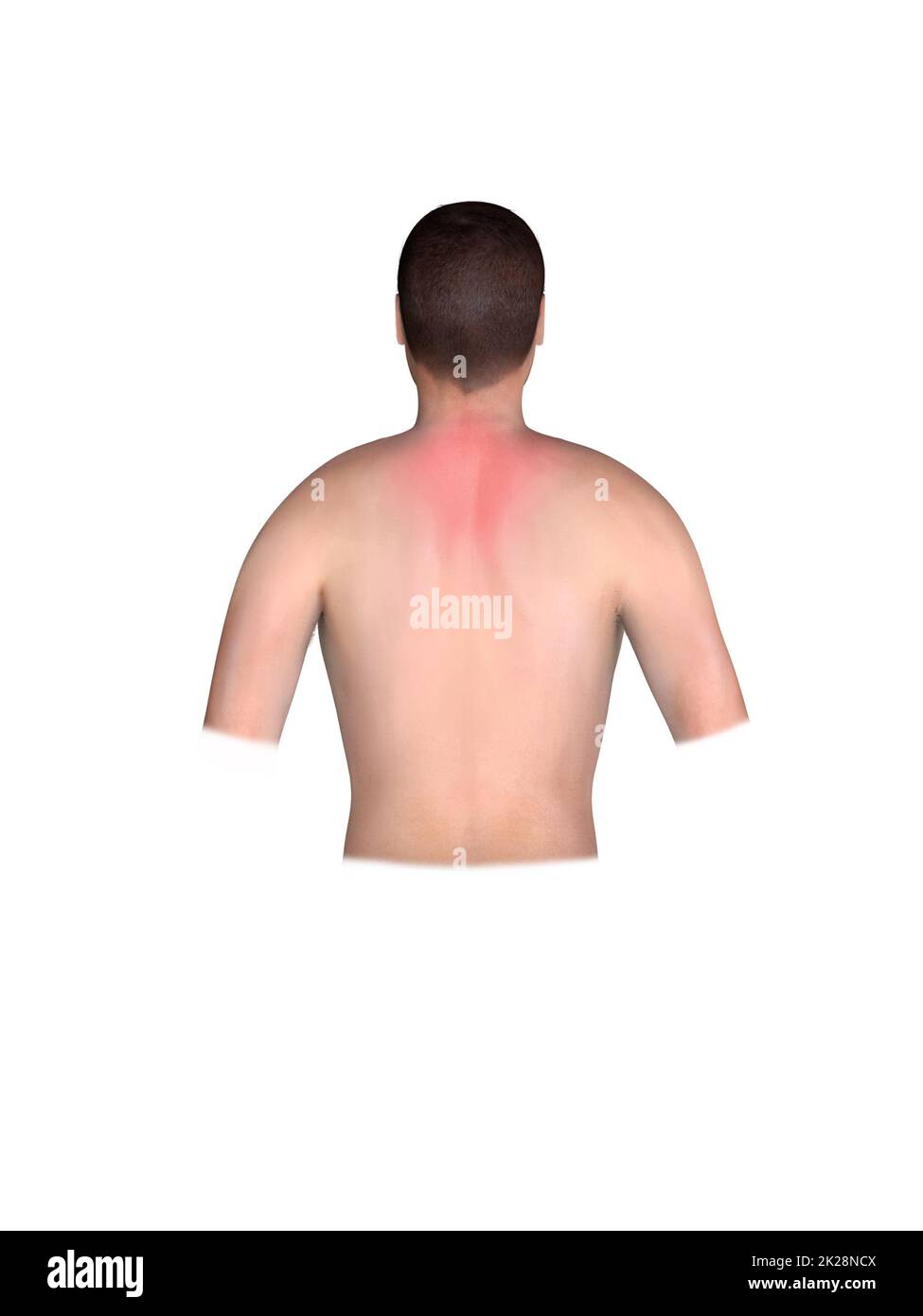 Radiating pain illustration Cut Out Stock Images & Pictures Alamy