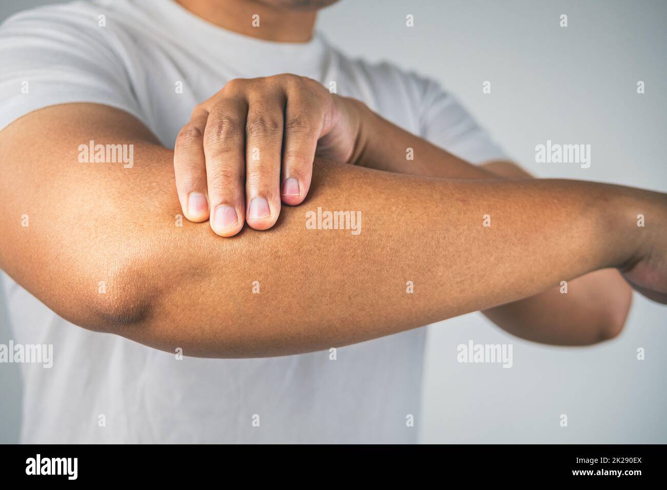 Tennis elbow concept. The man uses fingers to massage his arm. Healthcare knowledge. Medium close up shot. Stock Photo