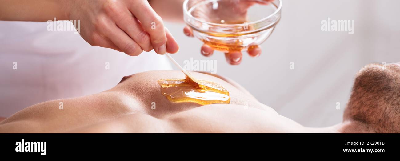 Wax Hair Removal. Waxing Male Chest At Spa Stock Photo