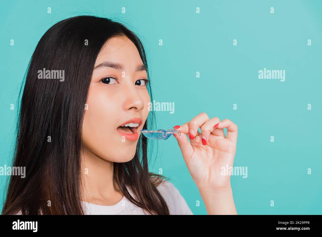 woman smiling wear putting silicone orthodontic retainers Stock Photo