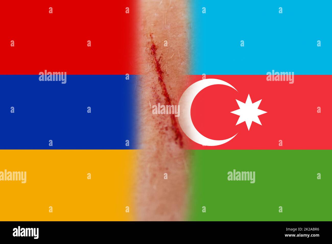 Defocus war. Conflict between Armenia and Azerbaijan over Nagorno-Karabakh. Let's stop the war. Azerbaijan and Armenia conflict. Country flags on woun Stock Photo