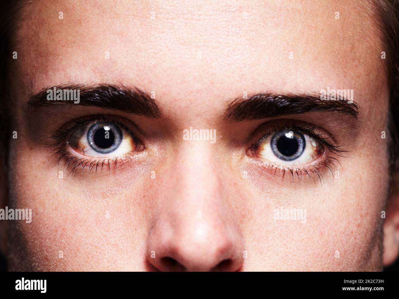 High as a kite. Closeup portrait of a young mans face with dilated pupils. Stock Photo