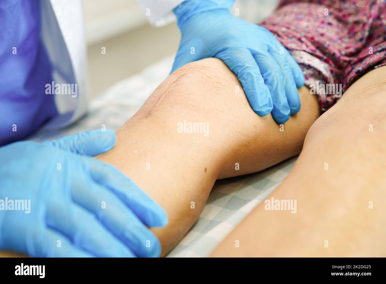 Asian elderly woman patient with scar knee replacement surgery in hospital. Stock Photo