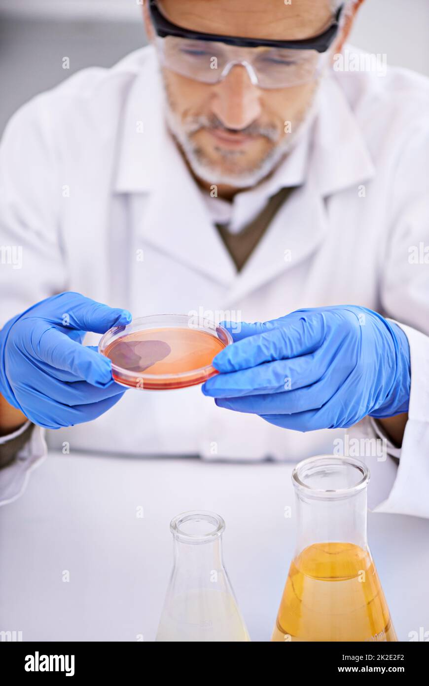 Lets see whats going on in there. Shot of a male scientist examining the contents of a petri