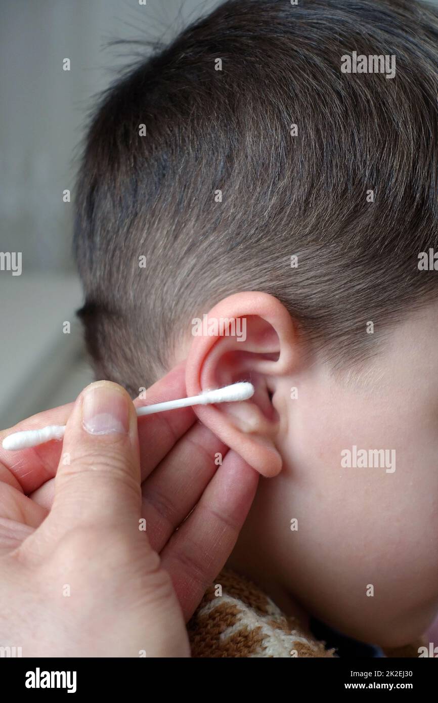 A parent cleans their child's ear with a cotton swab Stock Photo