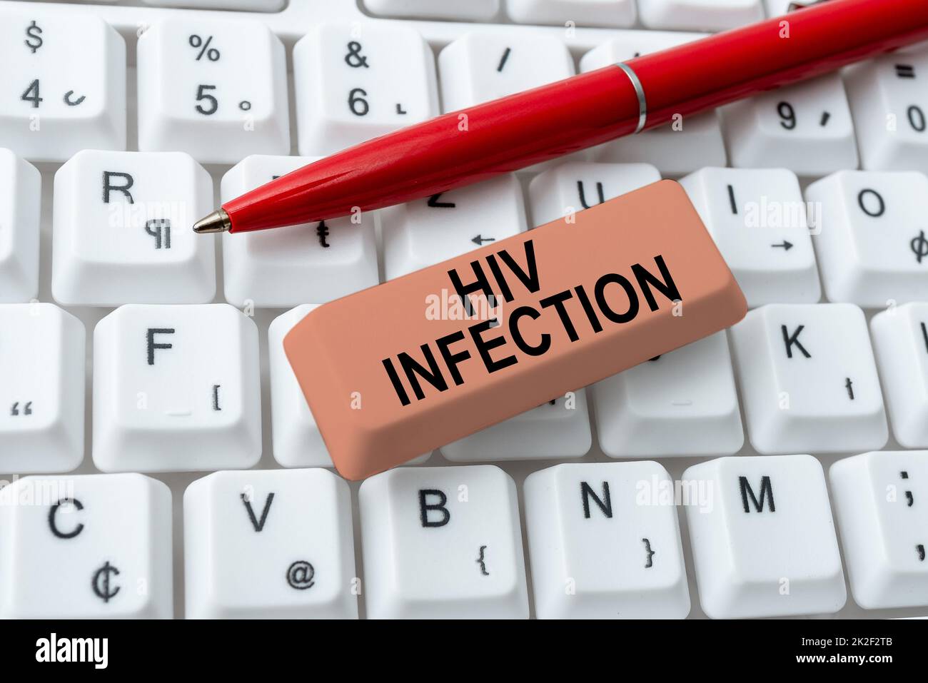Text showing inspiration Hiv Infection. Business approach A disease of the immune system due to the infection of HIV Abstract Fixing Outdated Websites, Maintaining Internet Connection Stock Photo