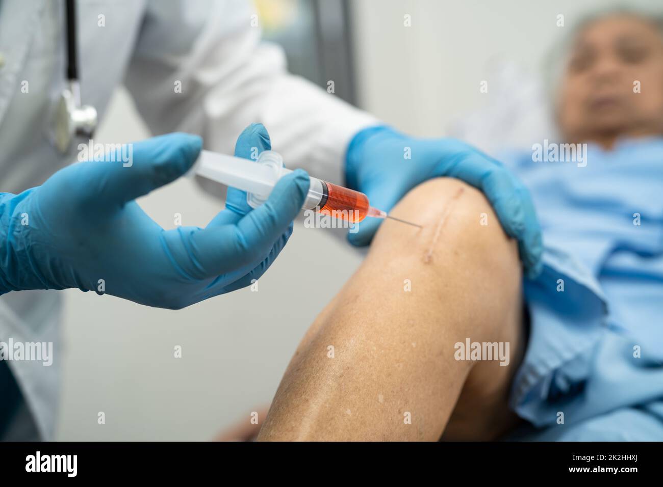 Asian doctor inject Hyaluronic acid platelet rich plasma into the knee of senior woman to walk without pain. Stock Photo