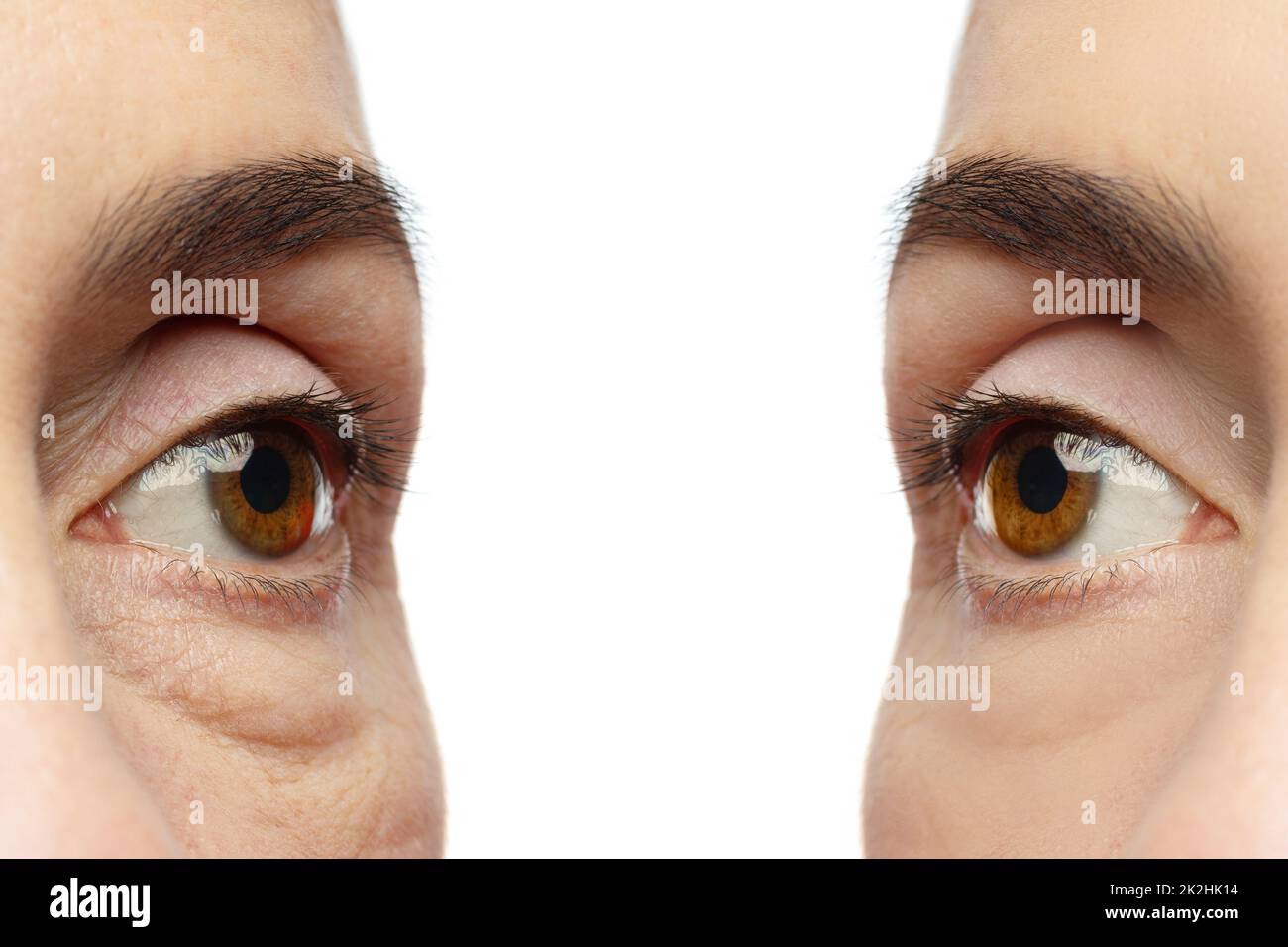 Anti aging treatment. Female eyes after rejuvenation Stock Photo Alamy