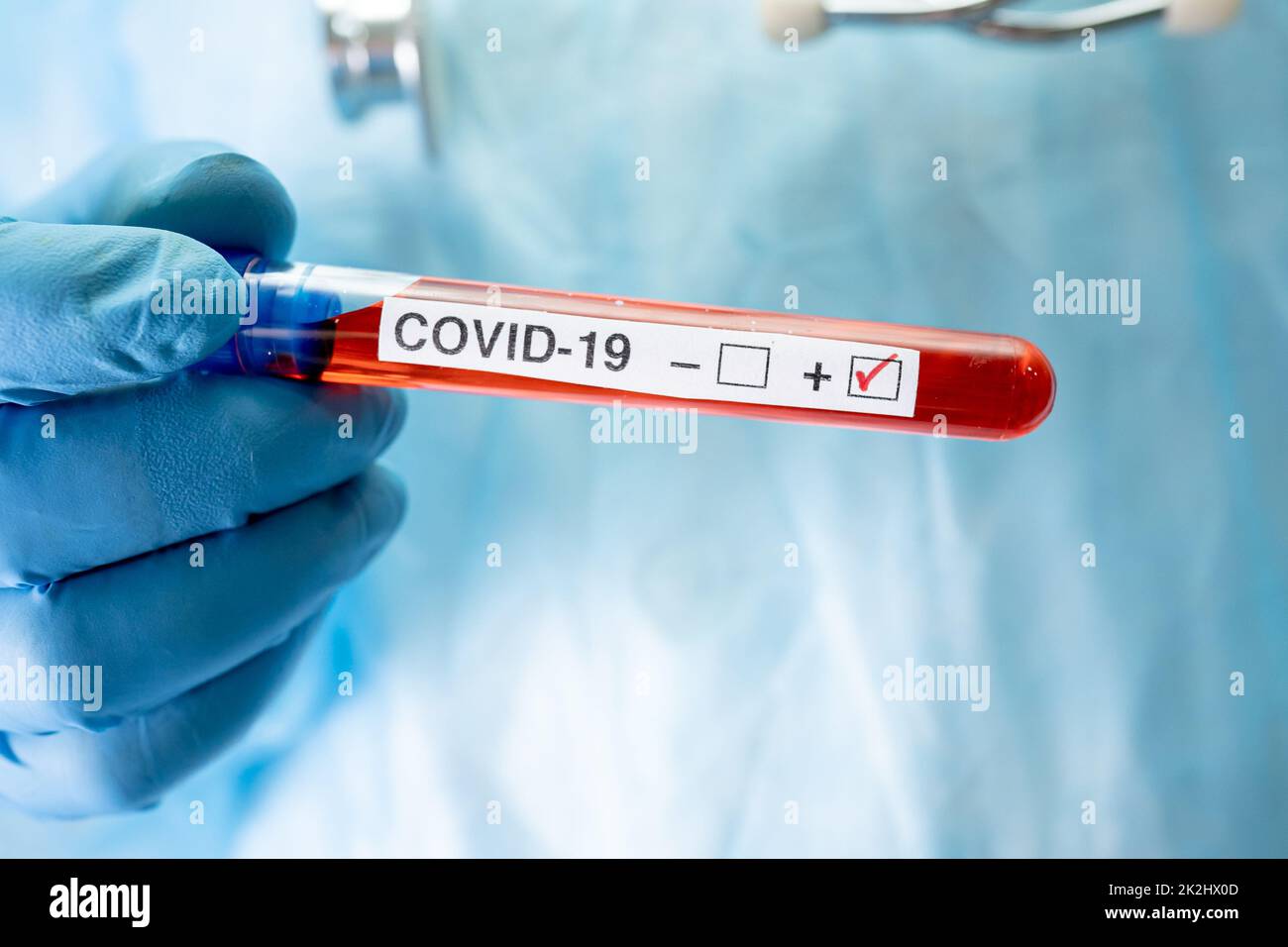 Positive blood infection sample in test tube for covid19 coronavirus in