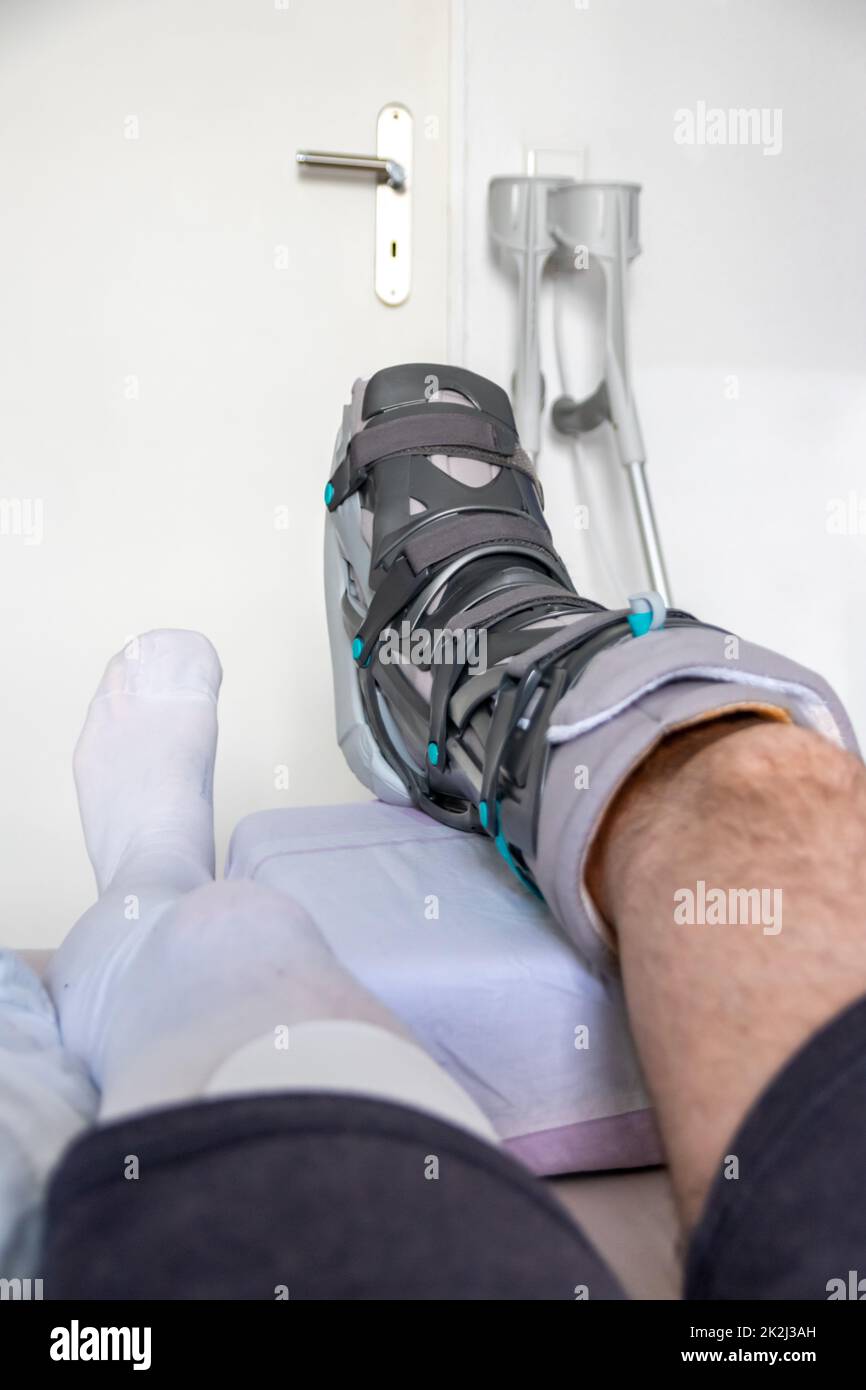 European man after Achilles tendon rupture operation is back home with special physiotherapy shoe and crutches for recovery at home with healthy medicine painkiller drug pills against the hurting leg Stock Photo