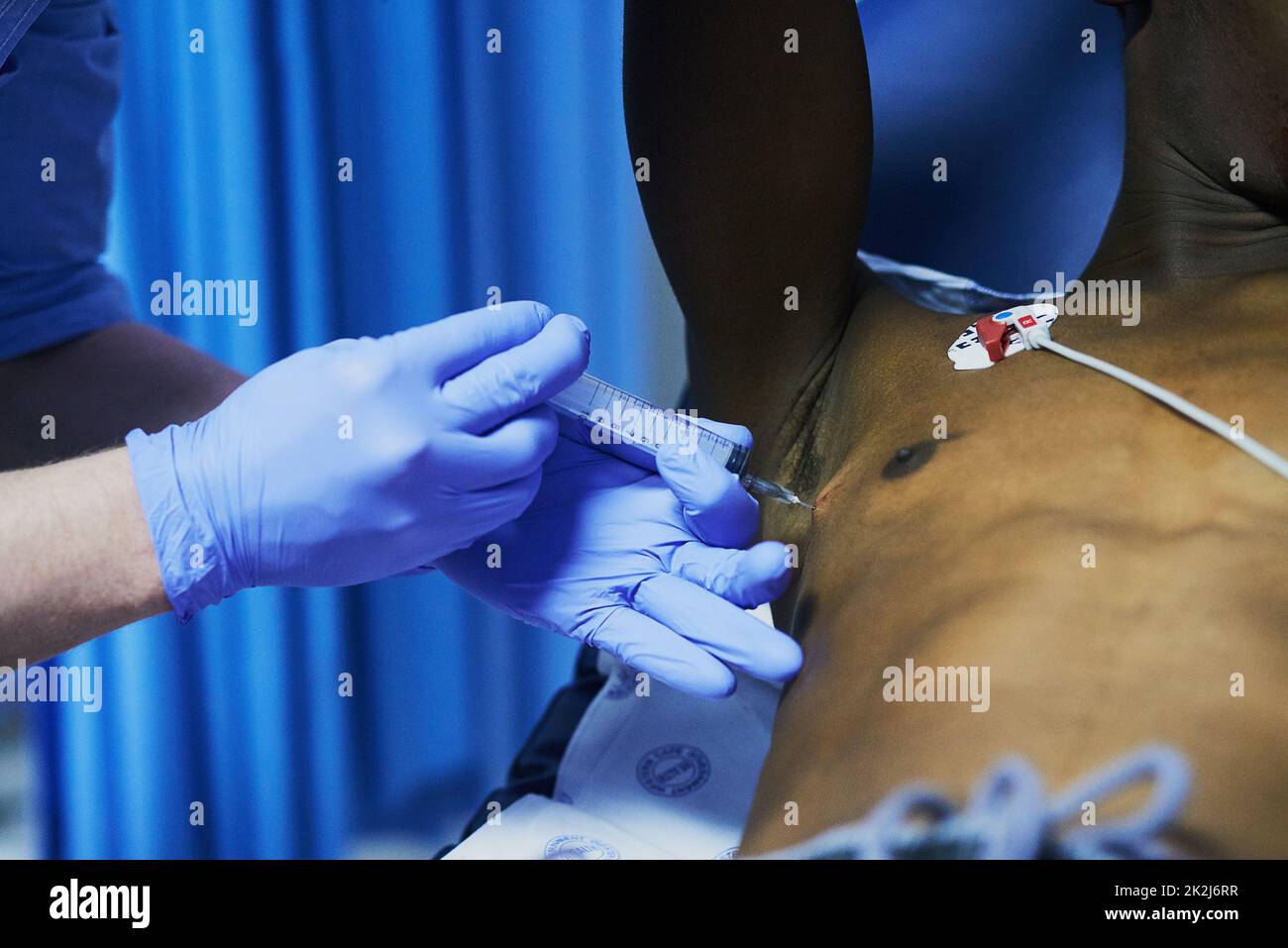 Anesthetizing the patient before a medical procedure Stock Photo
