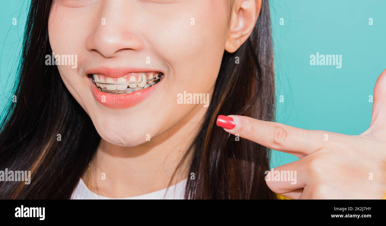 young woman teen pointing finger to teeth Stock Photo Alamy