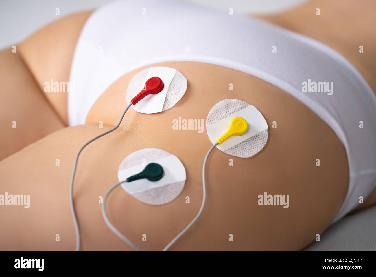 157 fotos e imágenes de Electrical Muscle Stimulation - Getty Images