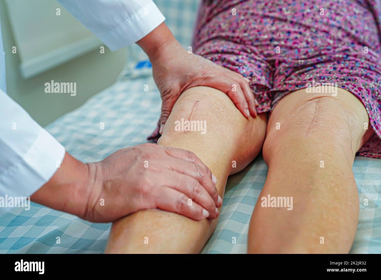 Asian elderly woman patient with scar knee replacement surgery in hospital. Stock Photo