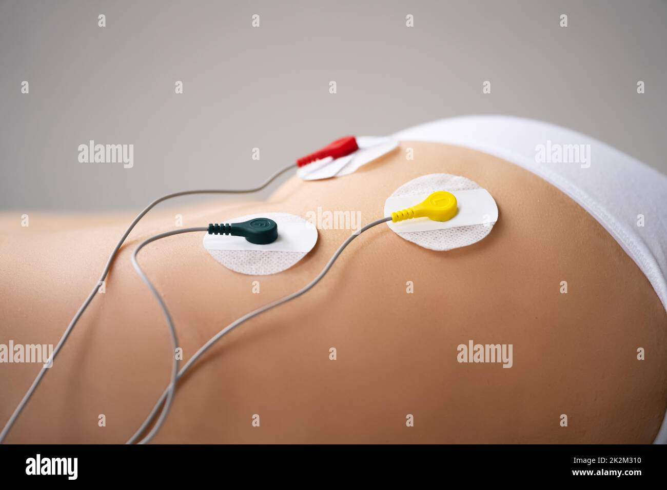 Electrode Muscle Stimulation Therapy Stock Photo