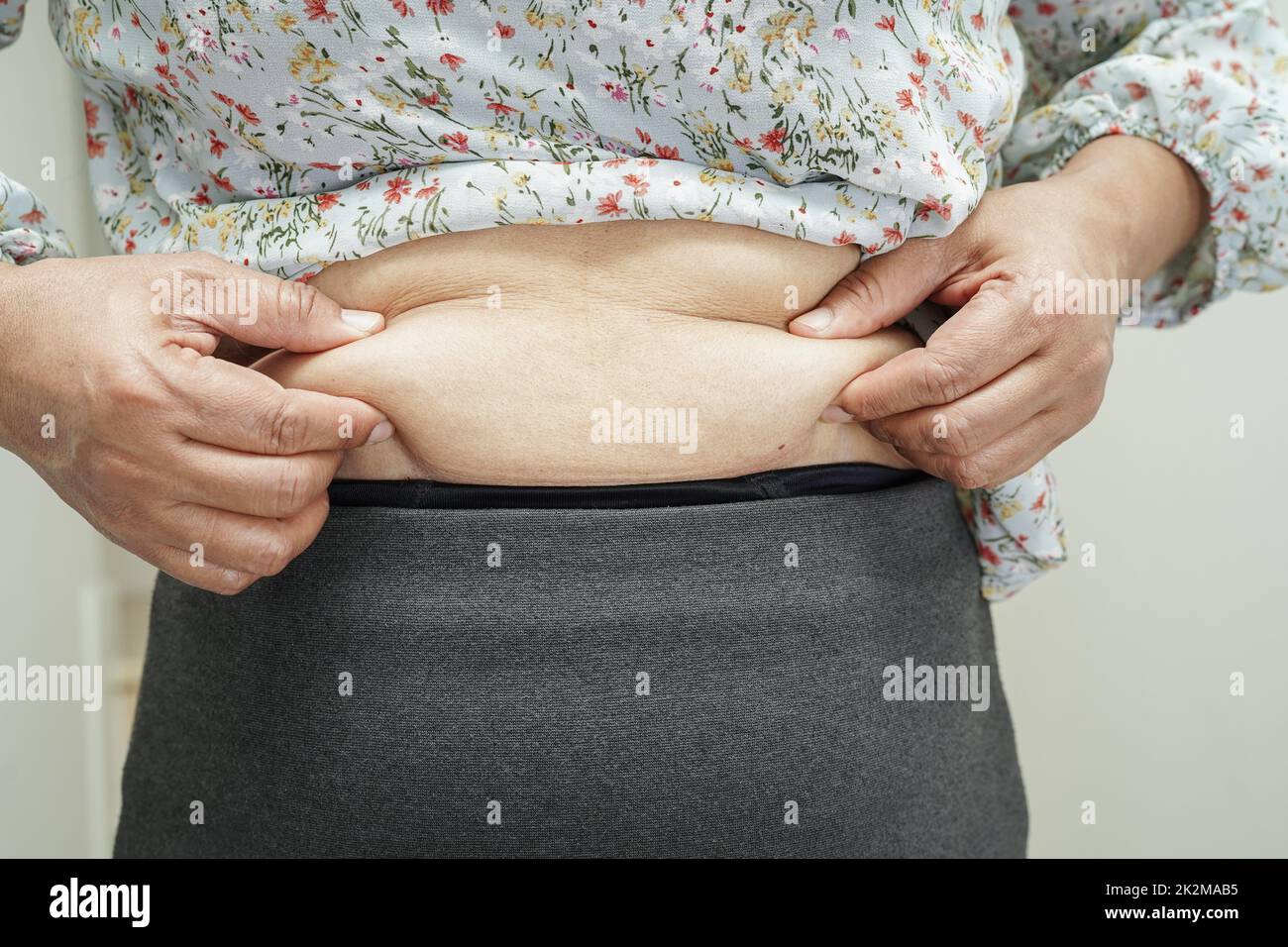 Woman grabbing skin on her flanks with the black color crosses marking,  Lose weight and liposuction cellulite removal concept, Isolated on white  backg Stock Photo - Alamy