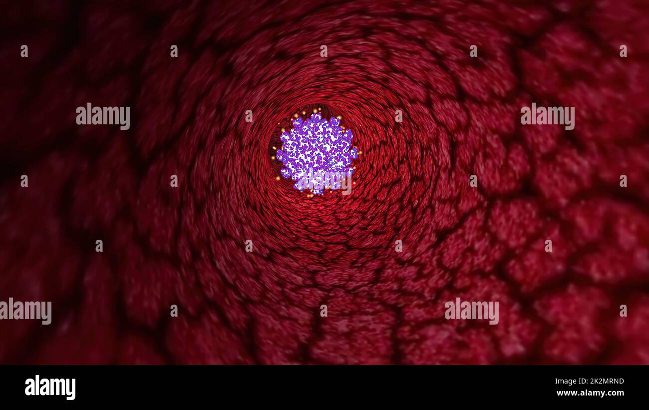 Virus Through A Vein Or Artery 3d illustration Stock Photo - Alamy