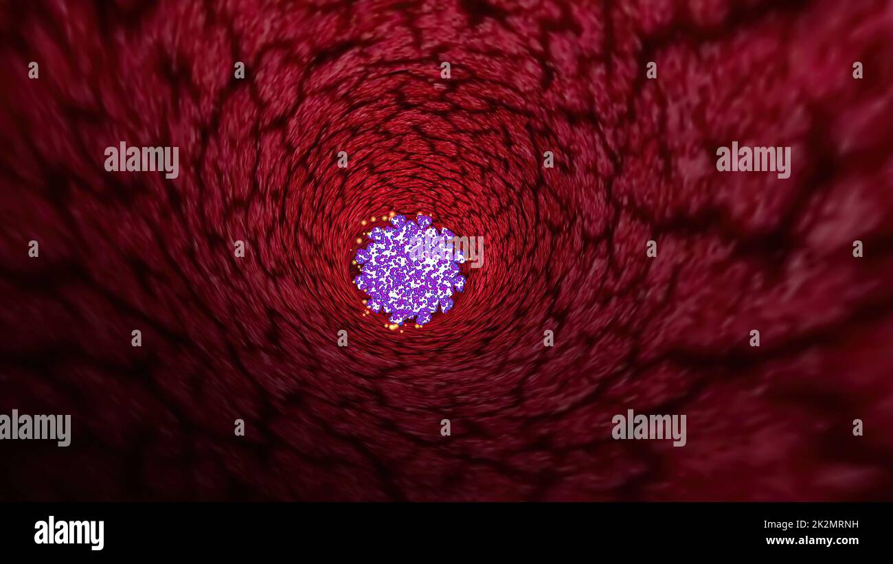 Virus Through A Vein Or Artery 3d illustration Stock Photo - Alamy