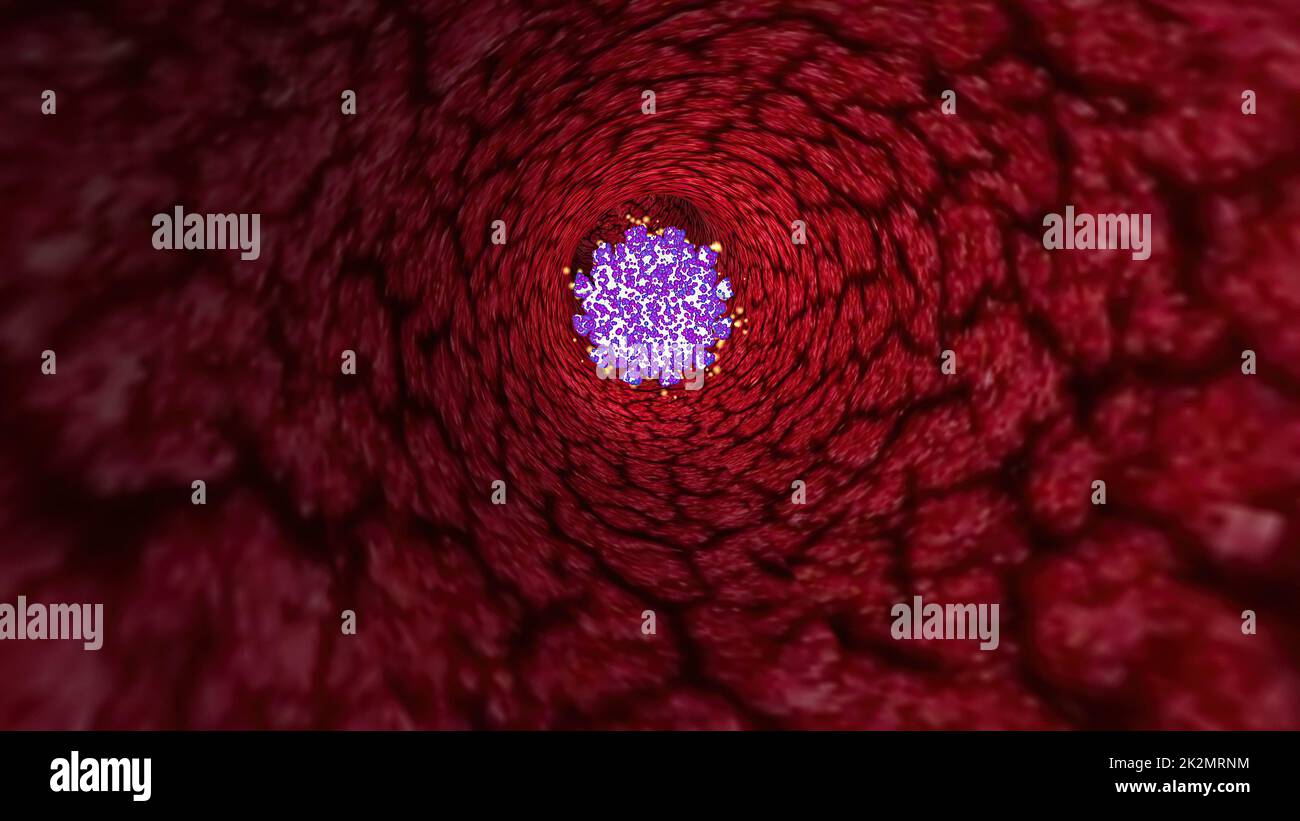 Virus Through A Vein Or Artery 3d illustration Stock Photo - Alamy