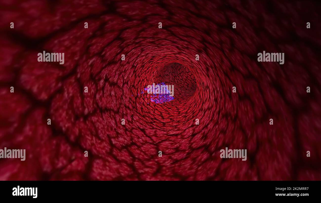 3d illustration of Virus Through A Vein Or Artery Stock Photo - Alamy