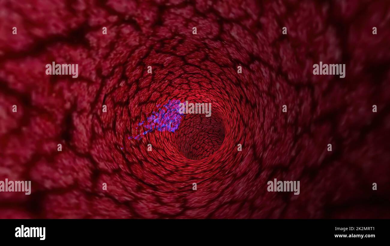 3d illustration of Virus Through A Vein Or Artery Stock Photo - Alamy