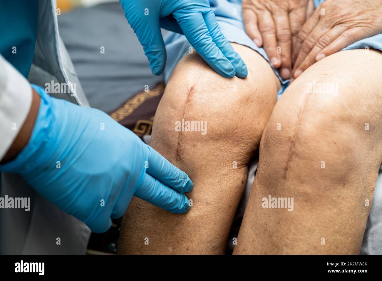 Asian doctor inject Hyaluronic acid platelet rich plasma into the knee of senior woman to walk without pain. Stock Photo
