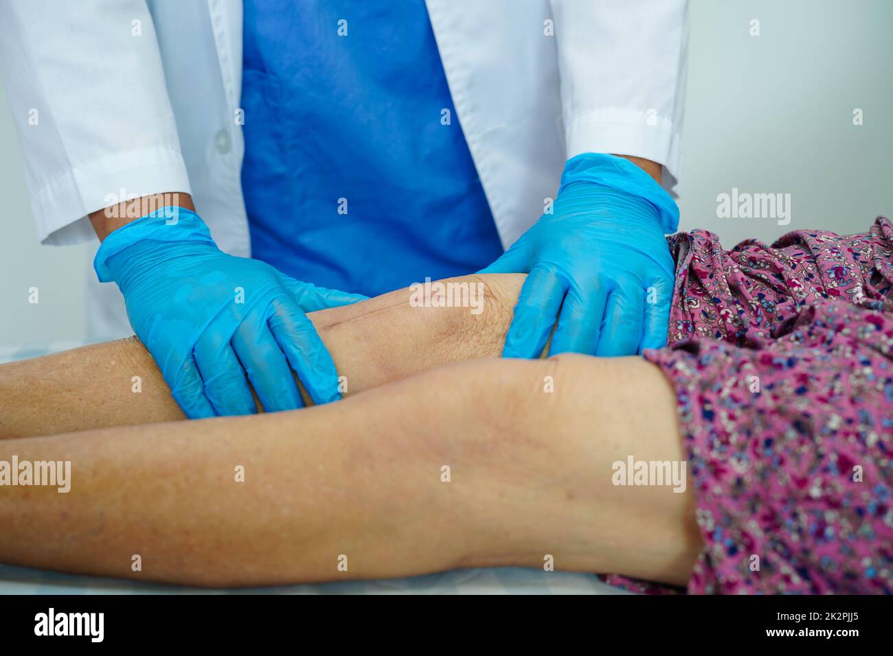 Asian elderly woman patient with scar knee replacement surgery in hospital. Stock Photo