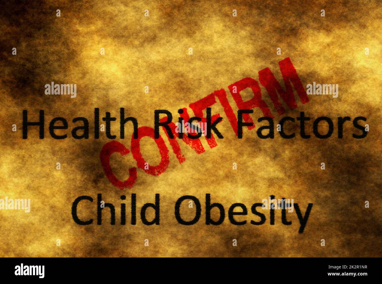 Child obesity confirm Stock Photo