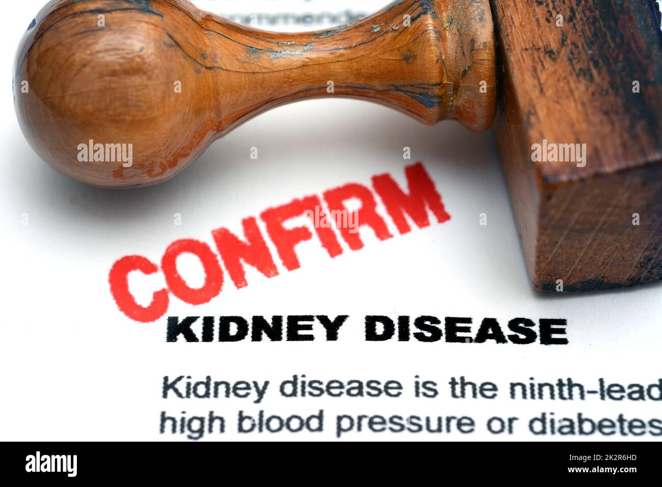 Kidney disease Stock Photo