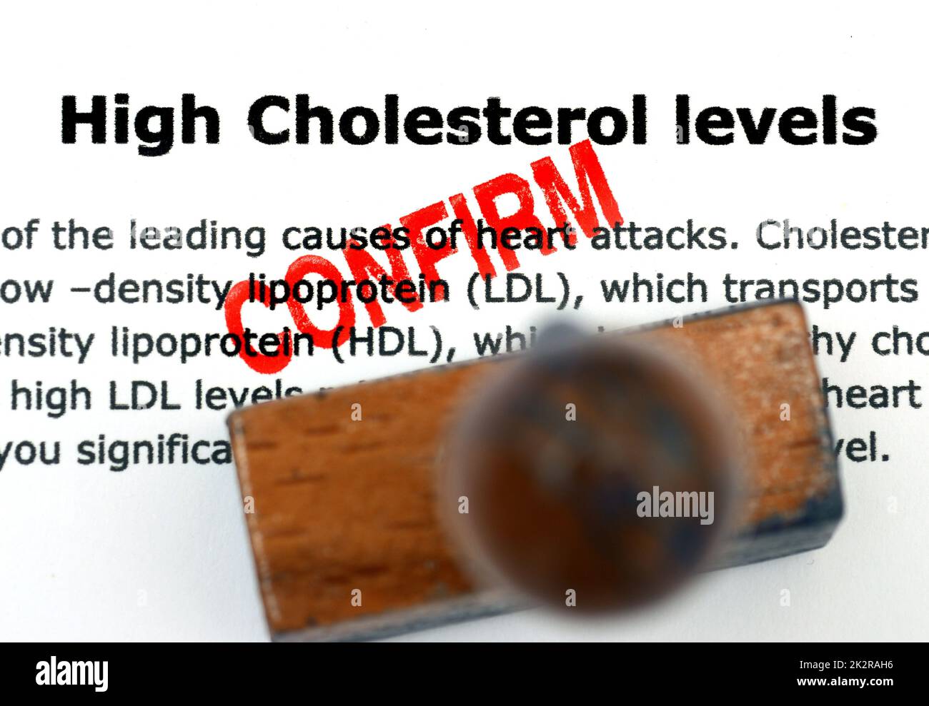 High cholesterol level Stock Photo Alamy