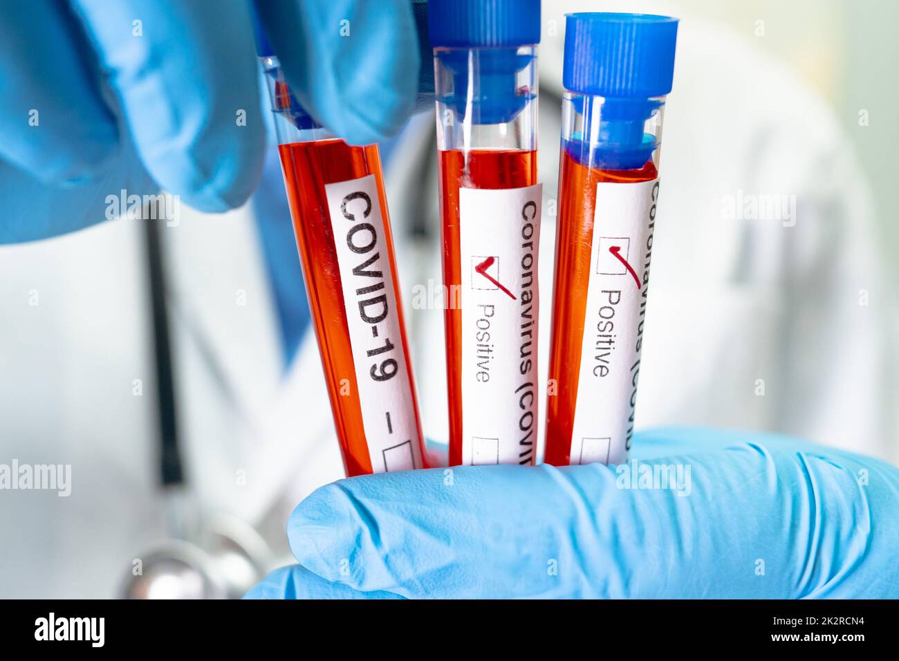 Positive blood infection sample in test tube for covid19 coronavirus