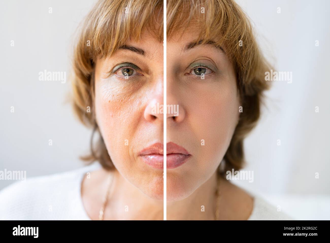 Woman With Before And After Rejuvenation Stock Photo Alamy