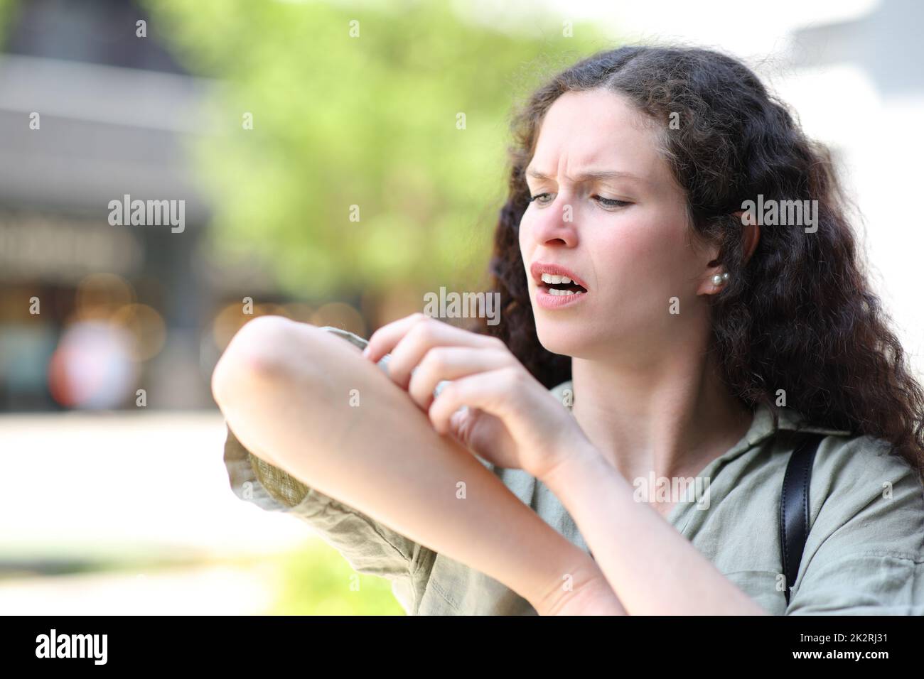 Stressed woman scratching arm in the street Stock Photo