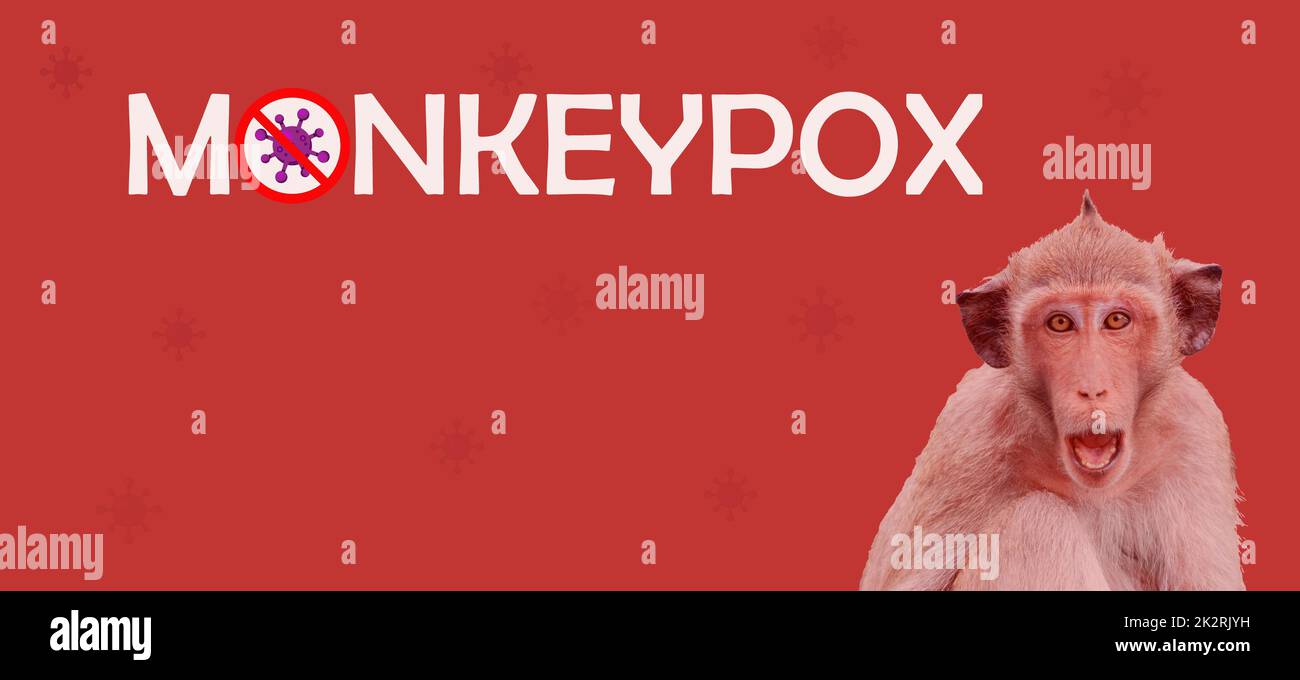 Monkeypox outbreak concept. Monkeypox is caused by monkeypox virus