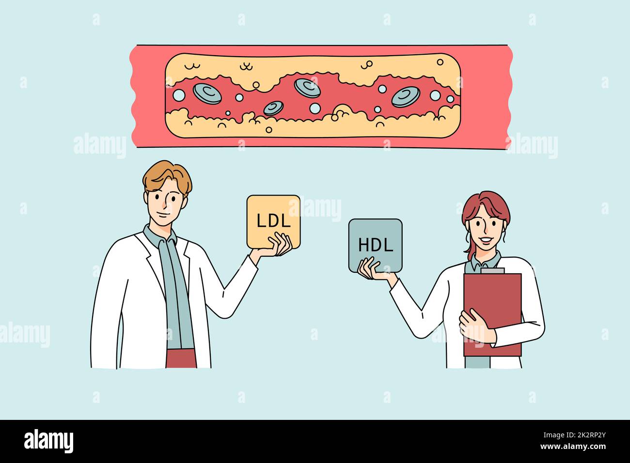 Doctors show levels of cholesterol in human vessels Stock Photo