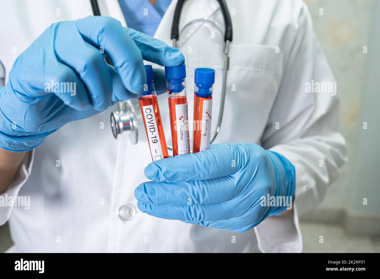 Positive blood infection sample in test tube for covid19 coronavirus