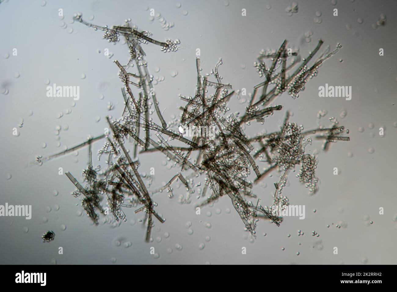 Mold filaments and spores Stock Photo
