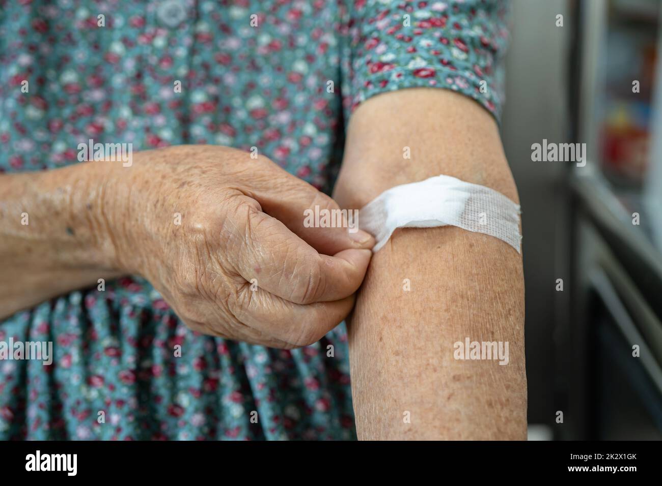 Asian senior or elderly old lady woman patient show cotton wool stop bleeding, after blood drawing testing for annually physical health check up to check cholesterol, blood pressure, and sugar level. Stock Photo