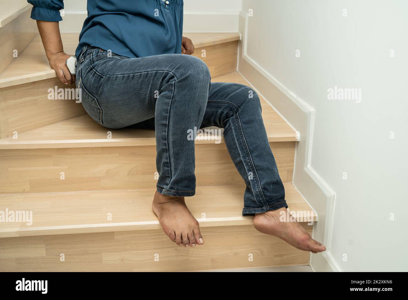 Asian lady woman patient fall down the stairs because slippery surfaces Stock Photo