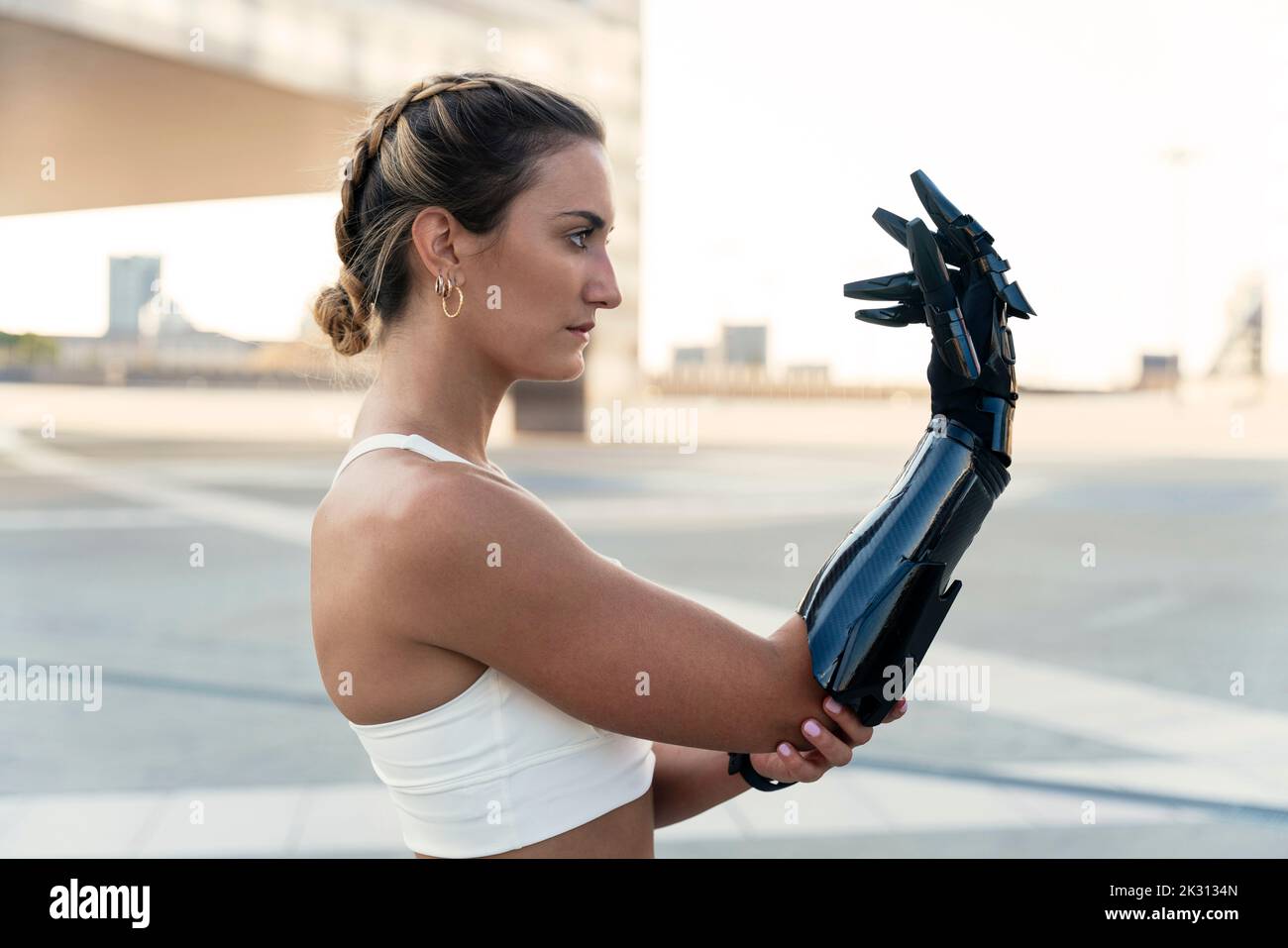 Beautiful young woman looking at arm prosthesis Stock Photo