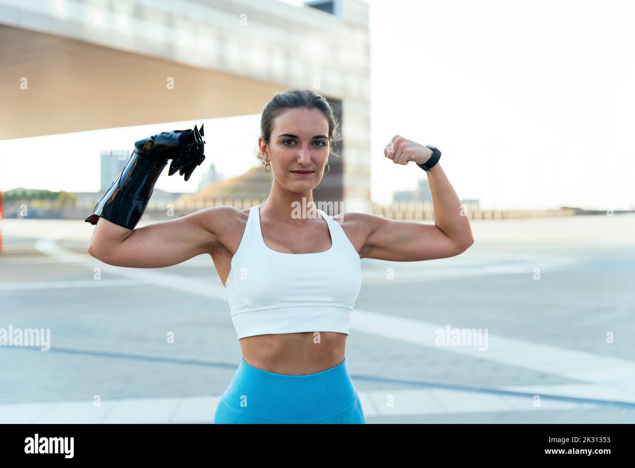 Smiling woman with arm prosthesis flexing muscles Stock Photo