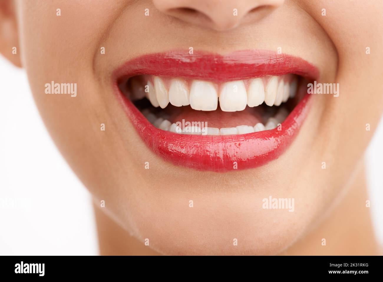 A shiny white smile. Cropped closeup shot of a beautiful young womans mouth. Stock Photo