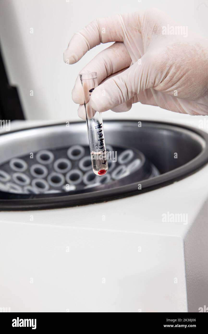 Test tube with bone marrow cells pellet obtained after centrifugation