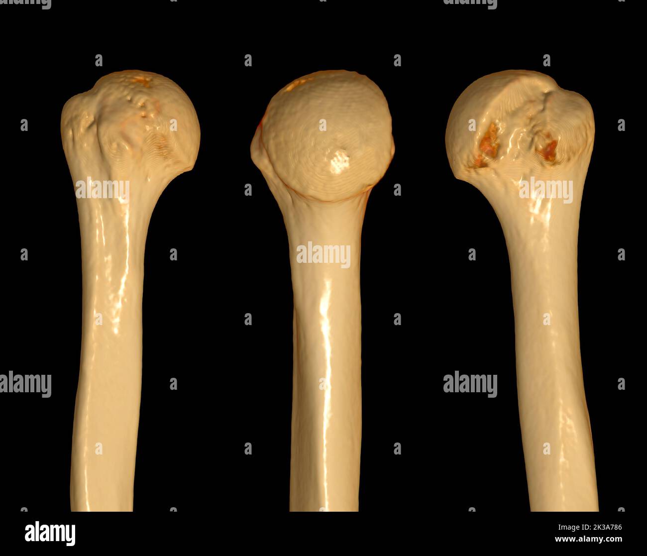 Humerus bone hi-res stock photography and images - Alamy