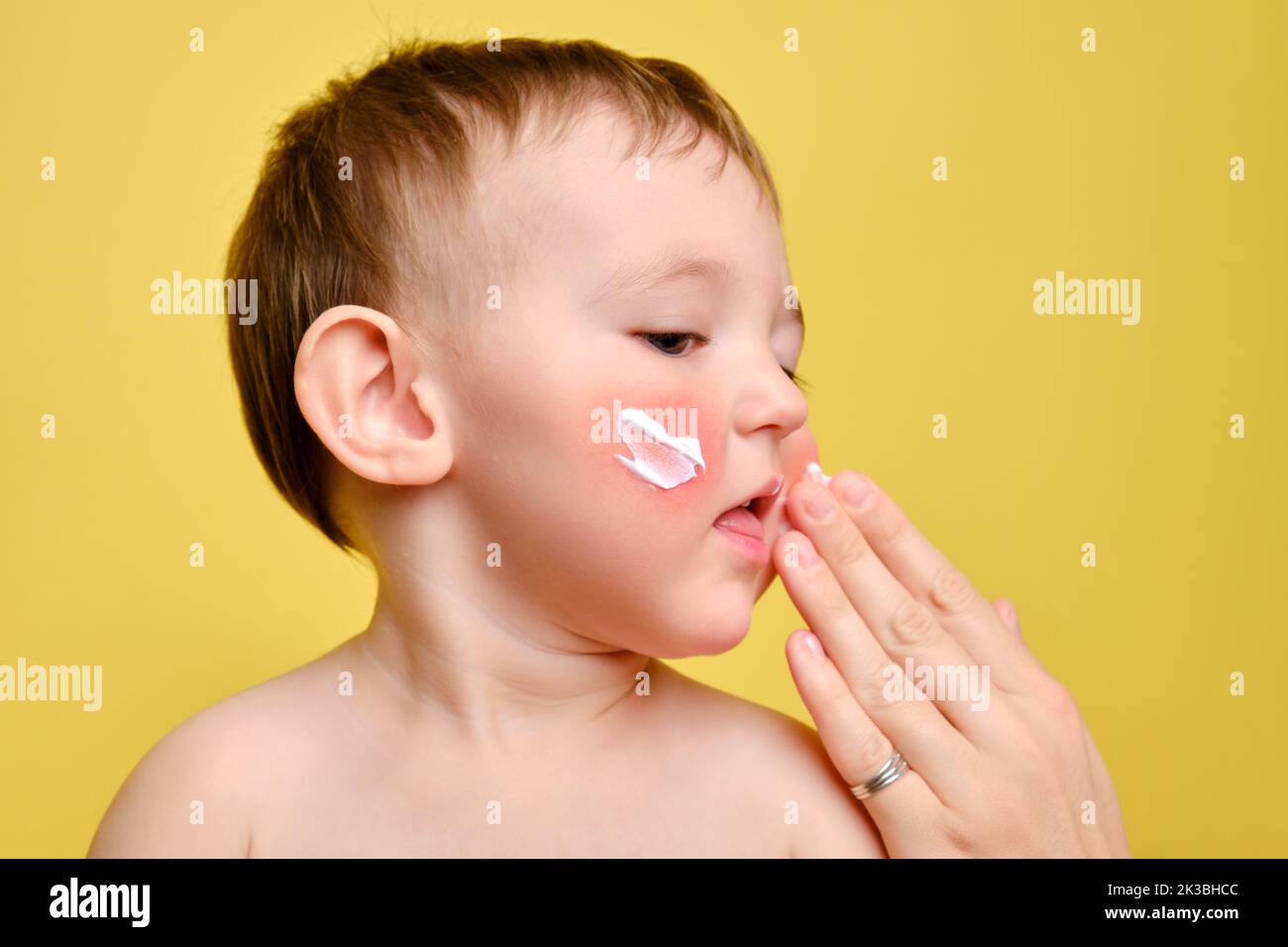 Mother smears allergy cream on face of toddler baby, studio yellow