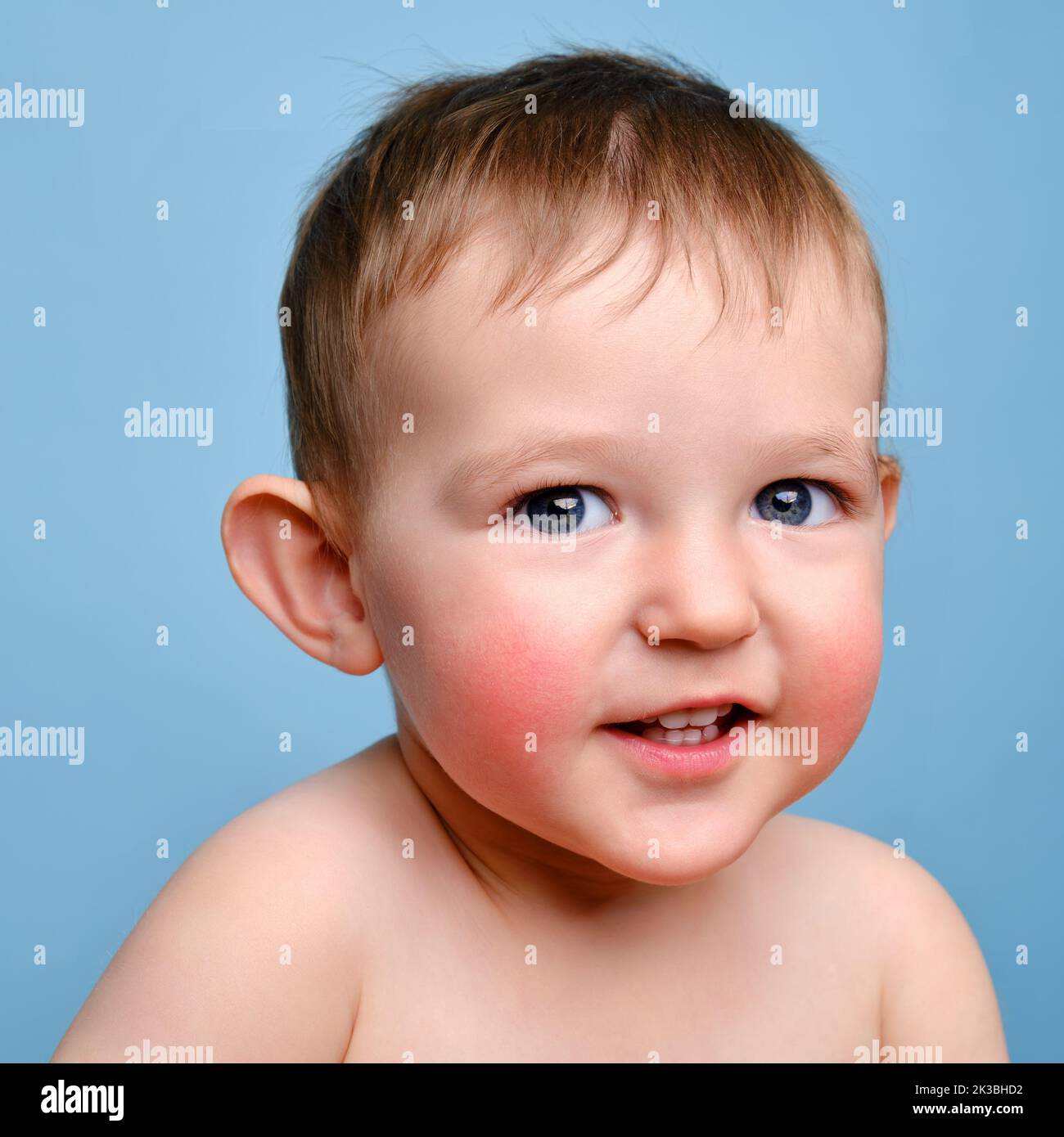Happy toddler baby with allergies on her face, blue studio background
